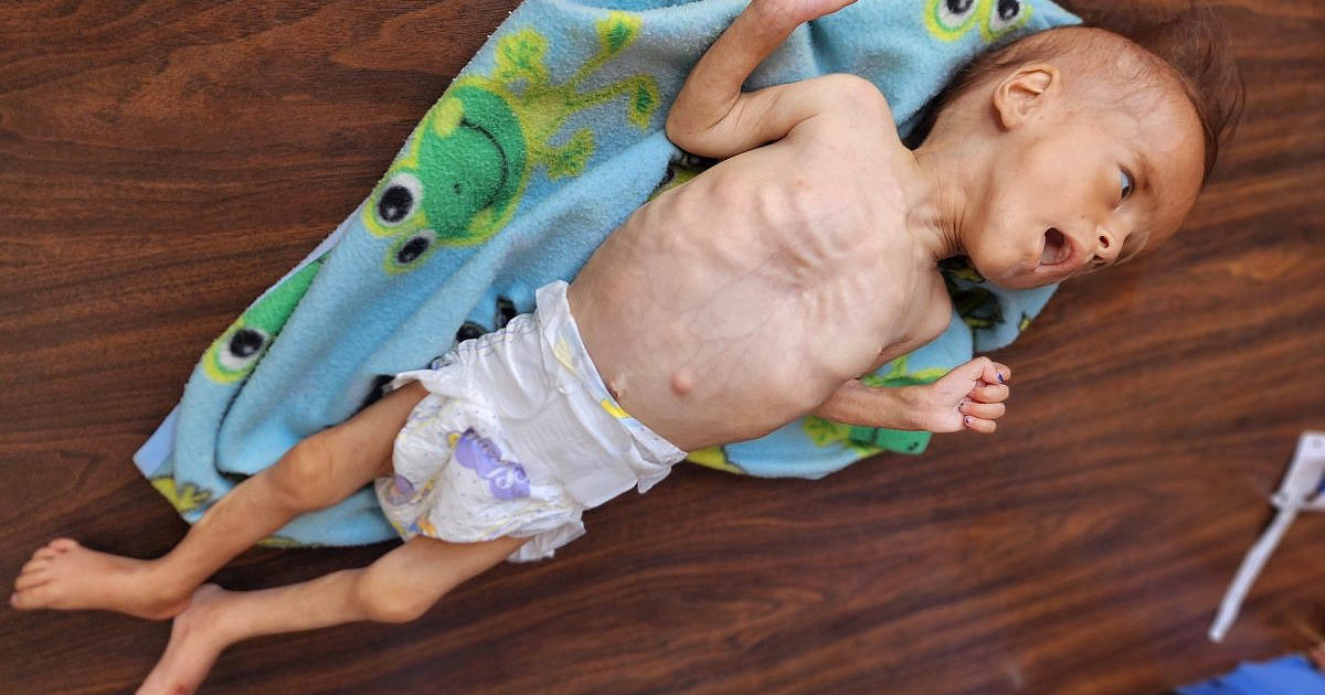 A ajuda para as crianças famintas de Gaza está bem na porta. Deixem entrar
