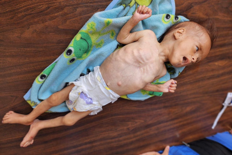 A ajuda para as crianças famintas de Gaza está bem na porta. Deixem entrar